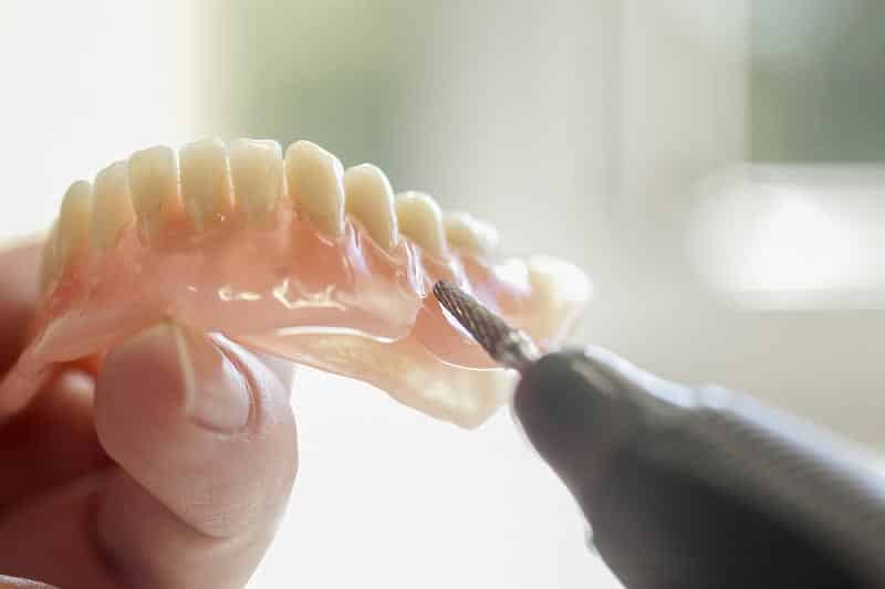 What Is Relining A Denture at Barbara Cleary blog