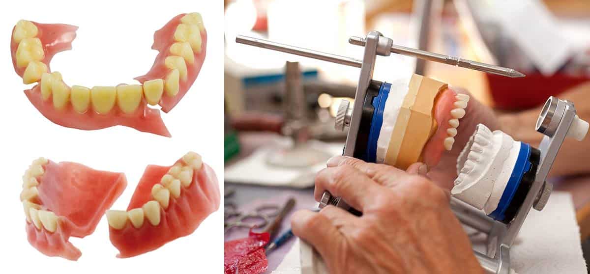Denture Teeth Repair & Broken Denture Tooth Repair | Denture Repair Lab